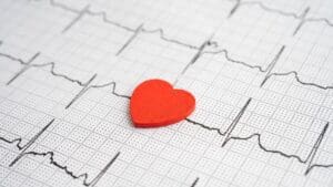 Panvel oferecerá exame de eletrocardiograma em 340 lojas