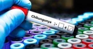 Chikungunya: Estado de São Paulo tem primeiro caso de morte
