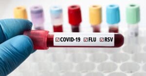 Covid-19: Brasil registra primeiros casos de nova variante