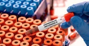 Novas epidemias: os vírus em que especialistas estão de olho em 2026