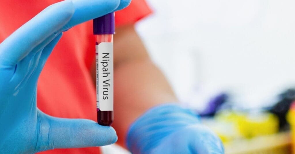 Nipah-vírus-causa-preocupação-na-Ásia-e-deixa-aeroportos-em-alerta