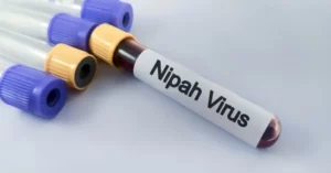 virus-nipah-1024×536