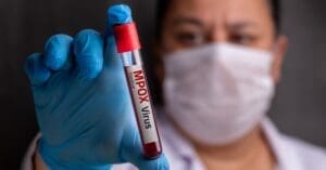 Mpox mata? Pega pelo ar? Beijo transmite? veja as principais buscas do Google sobre a doença