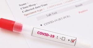 Covid: virologistas fazem alerta sobre nova variante BA.3.2