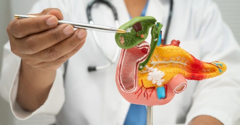 medico-aponta-para-pancreas-em-modelo-de-anatomia humana-conceito-de-pancreatite-cancer-de-pancreas